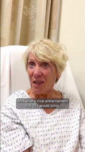 Age 76 Facelift: 2 Years Later, Still Getting Better!