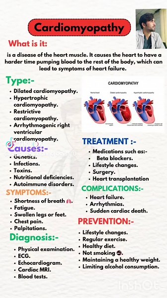 Understanding Cardiomyopathy: Causes and Management