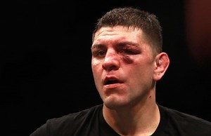 5 reasons why Nick Diaz will find it difficult to thrive in the current UFC middleweight division