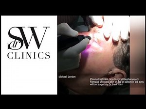 Dr SW Clinics - The Non-Surgical Blepharoplasty procedure