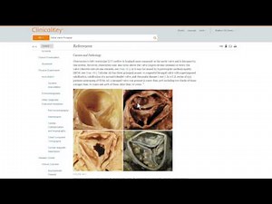 ClinicalKey Overview