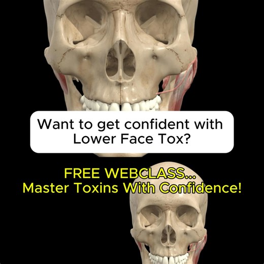 How to Fix a Spock Brow: The 2-Step Solution ⬇️ Early in my career, I gave an older patient a huge Spock brow. I was mortified. A true Spock brow isn't just an over-lifted brow—it involves medial brow ptosis (a drop) paired with lateral brow elevation (a lift). Here's my proven 2-step approach to fix it: ✅ Step 1: Soften the lateral brow with just one unit into the upper lateral frontalis ✅ Step 2: Make sure the brow depressors are relaxed by treating the glabella and procerus Want to create saf