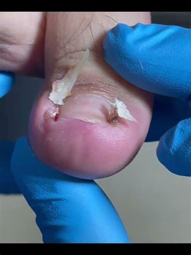 Beautiful Toenails Solve Long-Standing Problems #nails #satisfying