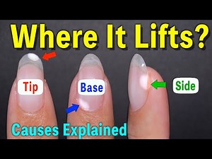 Why Your Gel Nails Keep Peeling Off – Causes and Fixes Explained【ASKA NAILS】