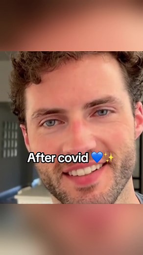 Unleash the Magic of Eye Color Change! 🌈✨ Fancy Drops color changing eye drops have now become a popular product for beauty lovers around the world to change their eye color naturally. ✨🤩 It‘s a perfect revolutionary product to show off your natural beauty eyes.👀 So make sure to try it out today.🔥 We have 10 different color options and lightening & brightening drops right now.🥰 🛍Visit website:👉 www.fancydrops.co and get yours now! #fancydrops #eyecolor #eyetok #hazeleyes #ambereyes #eyeco