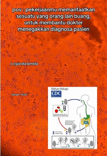 Understanding Giardia Lamblia: Microscopic Insights