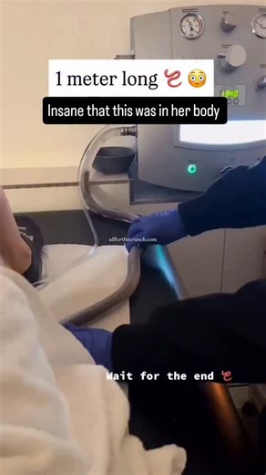 ℝ𝕚𝕤𝕖𝕤𝕒𝕓𝕠𝕧𝕖𝕚𝕥𝕒𝕝𝕝- Functional + Holistic Medicine on Instagram: "This is called a colonic. Many people use them to help clear out waste and debris during a cleanse. After personally deworming and passing liver flukes, I now cleanse twice a year because here’s the truth most people don’t want to talk about: Everyone deworms… except America. 😭👇 “Parasites have killed more people in human history than all wars.” — National Geographic Parasites aren’t rare, and they aren’t just a “thir