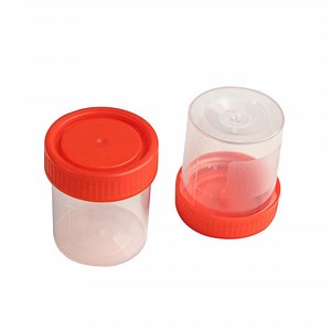 [Hot Item] Stool Specimen Collection Container Urine Sample Cup