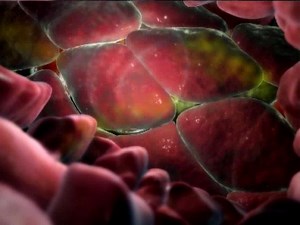 Body-Inflammatory Response