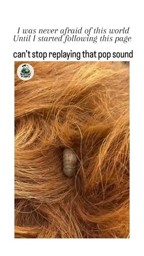 WildSide_Planet on Instagram: "This instagram reel depicts a hand extracting a botfly larva from a dog's skin, producing a distinctive "pop" sound that the poster describes as irresistibly replayable, tapping into the popularity of satisfying extraction content. , a curator of internet curiosities, on January 1, 2026, it amassed 2.3 million views in hours, reflecting the broad appeal of ASMR-style medical removals, which studies like those in Frontiers in Psychology (2018) link to dopamine relea