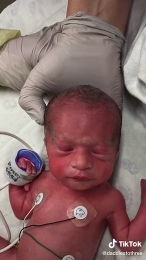 Triplet Birth Story: Jake Sean's Journey to Fatherhood