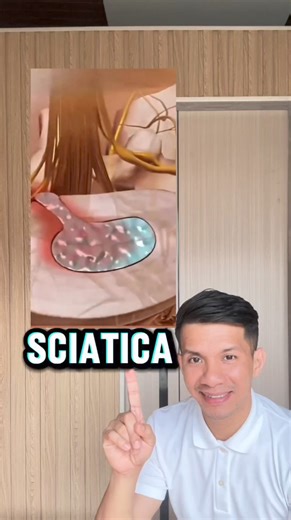 191K views · 1K reactions | THIS IS SCIATICA | Physical Therapy Session | Facebook