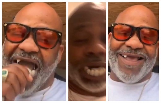 Damon Dash Addresses His TEETH Falling Out on Live Chat / Reveals Toothless Smile