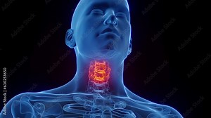 Animation of a man's inflamed neck bones