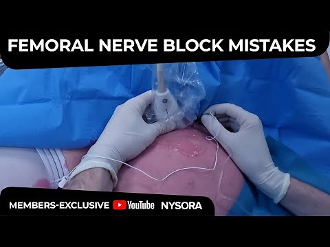 Femoral Nerve Block: Common Mistakes - Crash course with Dr. Hadzic