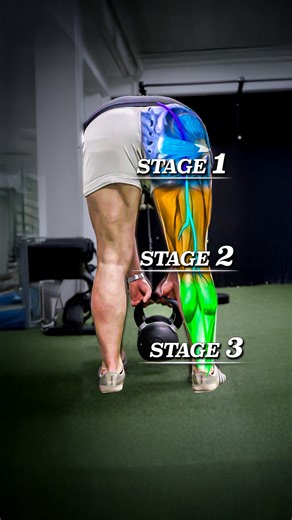 ⚡️ Sciatica Rehab Sciatica rehab should be done in 3 stages. Stage 1️⃣: Fix the root of the pain (your back). Here we work on reducing the disc herniation compressing your sciatic nerve roots. Stage 2️⃣: Strengthening the surrounding muscles to prevent the disc herniation from reocurring. Stage 3️⃣: Desensitizing your sciatic nerve. Here we calm down your sciatic nerve through nerve flossing stretching & mobilizing your spine. ✅ And if you want a LONG TERM plan to recover from sciatica for life,