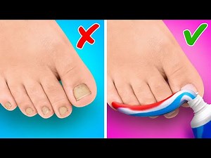 Amazing Feet Gadgets and Hacks || DIY Ideas For Your Shoes