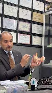كرمشة المعدة ESG على يد الجراح الاستشاري د.حيدرالرماحي Dr.haider alramahi
