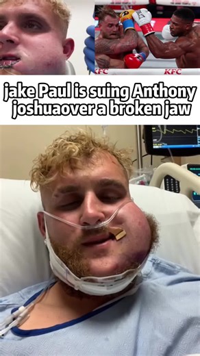 Jake Paul Sues Anthony Joshua Over Broken Jaw