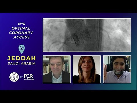 A patient undergoing TAVI - how should I achieve optimal coronary access? - Webinar
