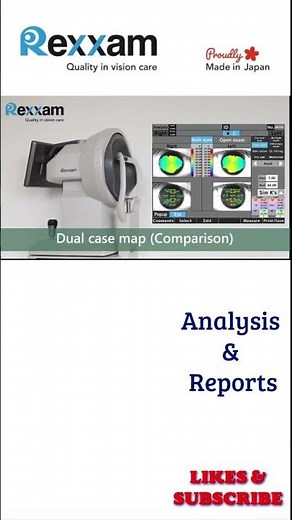 Corneal Topography System | Rexxam - RET 700