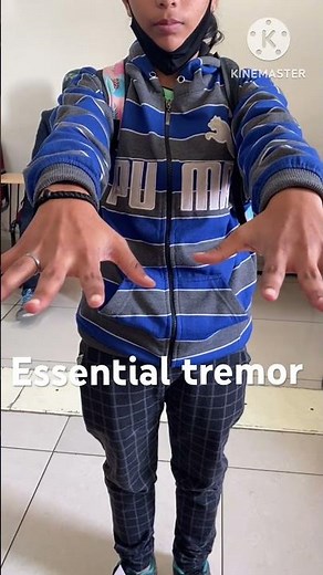 Essential tremor. These are high frequency, distal, postural tremor. Increased by anxiety & stress.