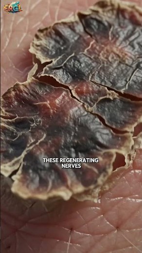Why Do Healing Wounds Itch? #skinrepair