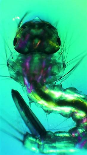 This is a Mosquito Larva! 🔬 #microscope