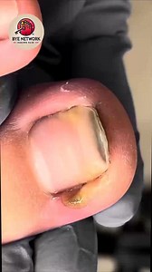 172K views · 582 reactions | Daily Nail Care Habits for Elderly Toenails For All-Day Relief #GentleToenailCare #WellnessNails #NailSupportSeniors #SafeSteps | Bye | Facebook