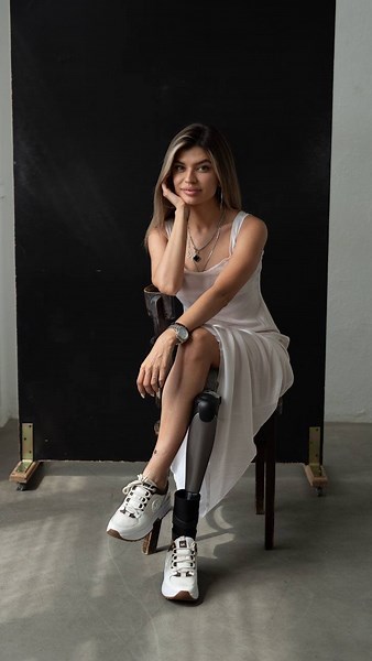 Кристина Макеева | Кошка без ножки 🐈‍⬛ on Instagram: "Если судьба подкидывает вам испытания, относитесь ко всему попроще — ведь после вы станете только сильнее! Очередная победа над собой: подъём пешком на 17-й этаж 🤯 Я это сделала 💪🏻"