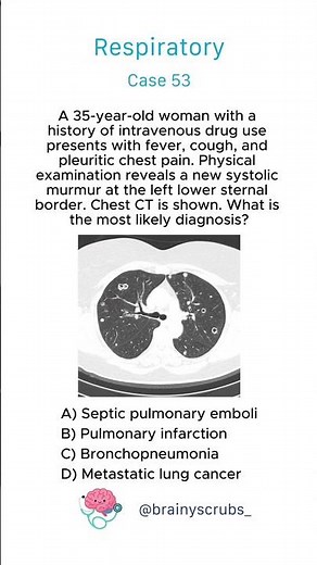 Respiratory - Case 53