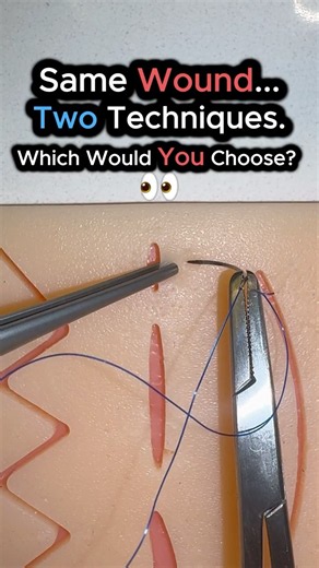 Simple Interrupted vs Horizontal Mattress Suture 🪡