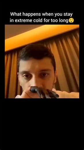 Evolve Insights on Instagram: "Severe frostbite in the fingers happens when prolonged exposure to extreme cold causes the skin and deeper tissues to actually freeze 🧊🖐️. At advanced stages, the fingers turn hard, cold, and completely numb, often appearing pale, waxy, bluish, or even black as blood flow shuts down. Pain may disappear, which makes the injury even more dangerous. As the tissue thaws, blisters can form and severe damage may be revealed underneath. In worst cases, the lack of circu