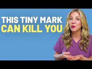 This “Mole” Could Be Cancer (What to Look For)