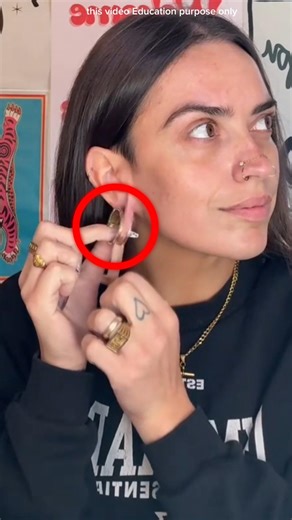 girl fixes her torn ear using bandages #shortsvideo