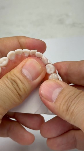 917K views · 3.6K reactions | Unbreakable Fiberflex! Corinth Dental in Mississippi | Luke Kahng | Facebook