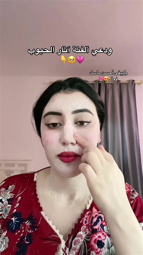 #آثار_الحبوب #وصفات_طبيعية | how to get rid of acne