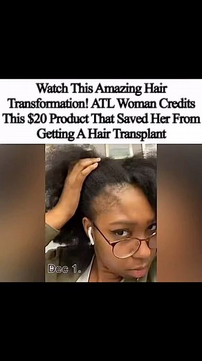 The Shade Room on Instagram: "Wow! Men lie, women lie, THESE RESULTS from @baskandlatherco don’t! They call the Scalp Stimulator magic in a bottle and now we see why. Growing hair and edges in no time! #baskandlatherpartner"