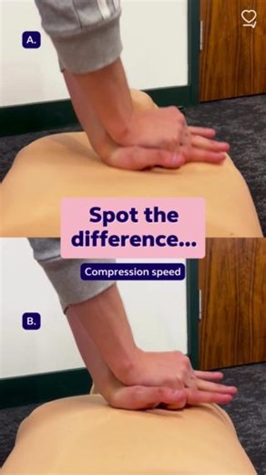 When it comes to chest compressions, it’s not about being the fastest. The optimal speed is 100-120 beats per minute, and mastering this can ensure the best chance of survival 💪 Can you spot which clip below is performing compressions at the best speed? The answer is clip B! | Resuscitation Council UK
