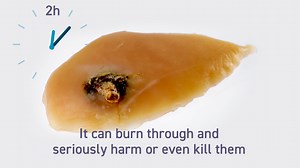 5.7K views · 17 reactions | Button batteries, in particular big,...