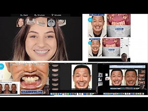 How to use Smilecloud 3DNA 1 2