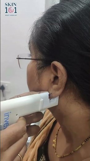 ear piercings with an ear gun machine | Skin101clinic