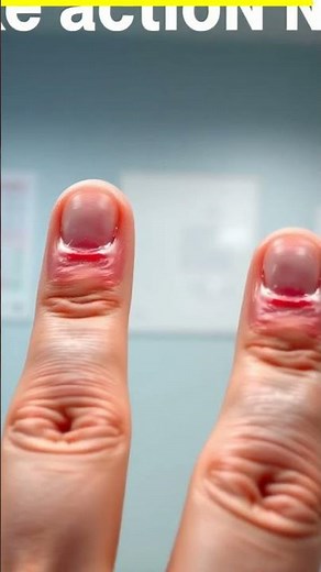Why Are Your Fingers Swelling Up?