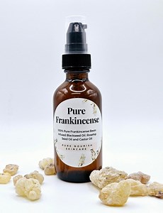 Frankincense Resin Infused Facial Oil: Organic Black Seed, Rosehip and Castor Oil | Vegan Skin Care | Natural Skin Care - Etsy