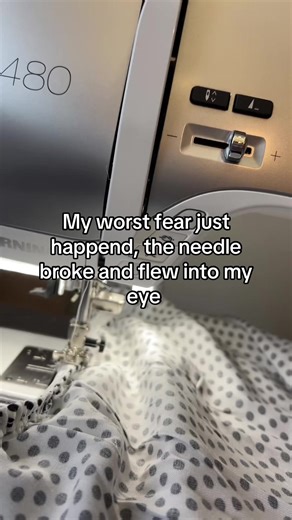 Sewing Mishap: Needle Accident Story