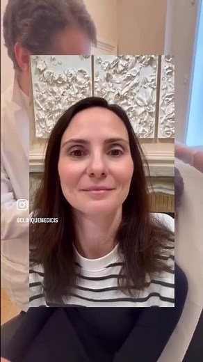 Injections de botox.