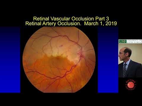Retinal Artery Occlusion