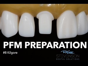 PFM Preparation #8  • Video • MEDtube.net