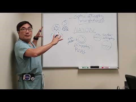 Optic Atrophy - Disc Morphology