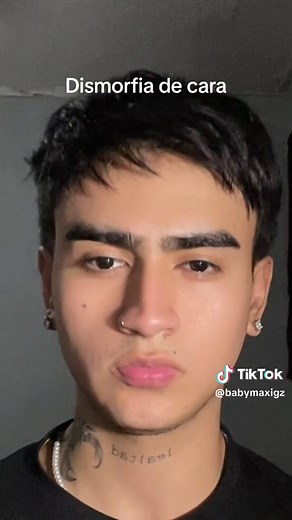 Understanding Facial Dysmorphia: Causes and Treatment Options